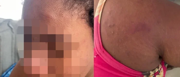 empregada-agredida-e-torturada-por-patroa-no-maranhao